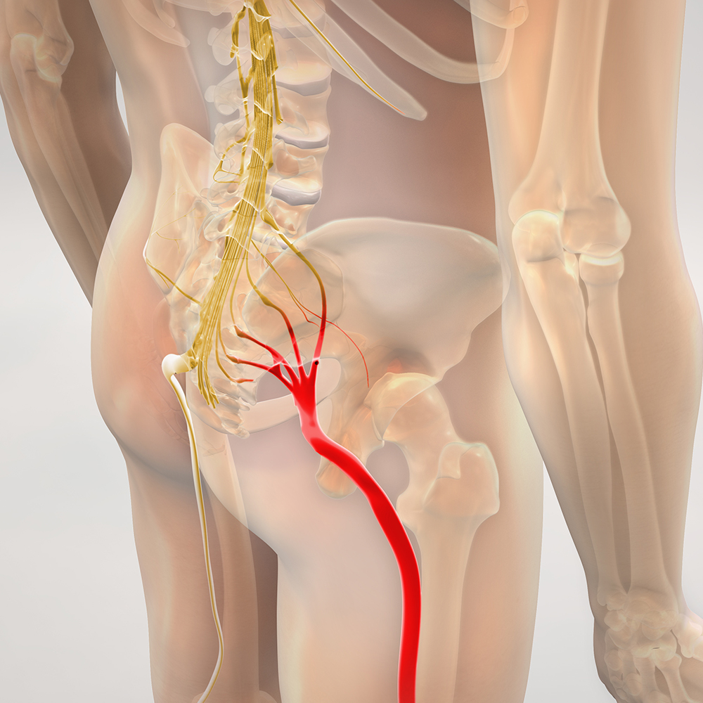 Symptom iskias nerve